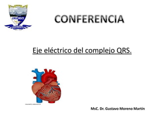Eje eléctrico del complejo QRS.
MsC. Dr. Gustavo Moreno Martín
 