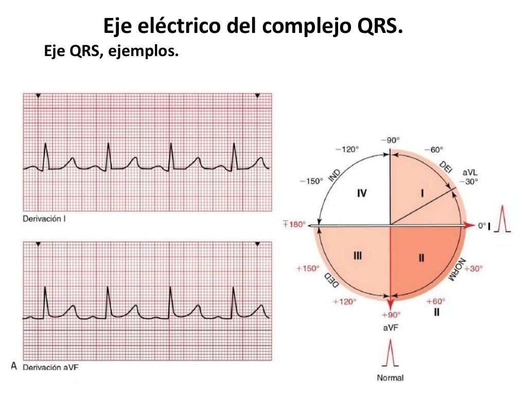 Eje eléctrico del complejo QRS. Eje eléctrico del complejo QRS.