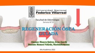 Semana N°25
Alumno: Huayra Quiroz, Irene Janeth
Docente: Romero Velarde, MarielaRuthsana
Facultad de Odontología
Año Académico 2022
 
