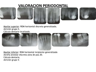 Horizontal Rom Ejemplo De Informe | PPTX