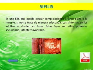 SIFILIS 
Es una ETS que puede causar complicaciones a largo plazo o la 
muerte, si no se trata de manera adecuada. Los síntomas en los 
adultos se dividen en fases. Estas fases son sífilis primaria, 
secundaria, latente y avanzada. 
 