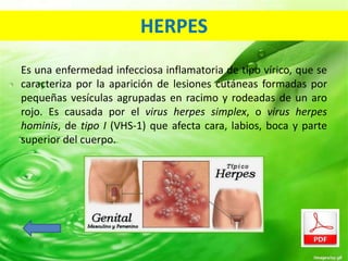 HERPES 
Es una enfermedad infecciosa inflamatoria de tipo vírico, que se 
caracteriza por la aparición de lesiones cutáneas formadas por 
pequeñas vesículas agrupadas en racimo y rodeadas de un aro 
rojo. Es causada por el virus herpes simplex, o virus herpes 
hominis, de tipo I (VHS-1) que afecta cara, labios, boca y parte 
superior del cuerpo. 
 