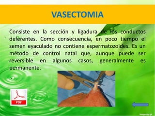 VASECTOMIA 
Consiste en la sección y ligadura de los conductos 
deferentes. Como consecuencia, en poco tiempo el 
semen eyaculado no contiene espermatozoides. Es un 
método de control natal que, aunque puede ser 
reversible en algunos casos, generalmente es 
permanente. 
 