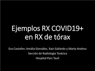 Ejemplos RX COVID19+
en RX de tórax
Eva Castañer, Amàlia González, Xavi Gallardo y Marta Andreu
Sección de Radiología Torácica
Hospital Parc Taulí
 