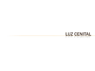 LUZ CENITAL
 