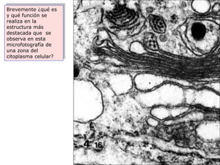 Brevemente ¿qué es
y qué función se
realiza en la
estructura más
destacada que se
observa en esta
microfotografía de
una zona del
citoplasma celular?
 