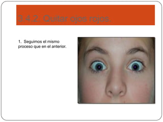 3.4.2. Quitar ojos rojos.
1. Seguimos el mismo
proceso que en el anterior.
 