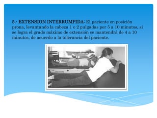 5.- EXTENSION INTERRUMPIDA: El paciente en posición
prona, levantando la cabeza 1 o 2 pulgadas por 5 a 10 minutos, si
se logra el grado máximo de extensión se mantendrá de 4 a 10
minutos, de acuerdo a la tolerancia del paciente.
 