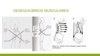 DESEQUILIBRIOS MUSCULARES
 