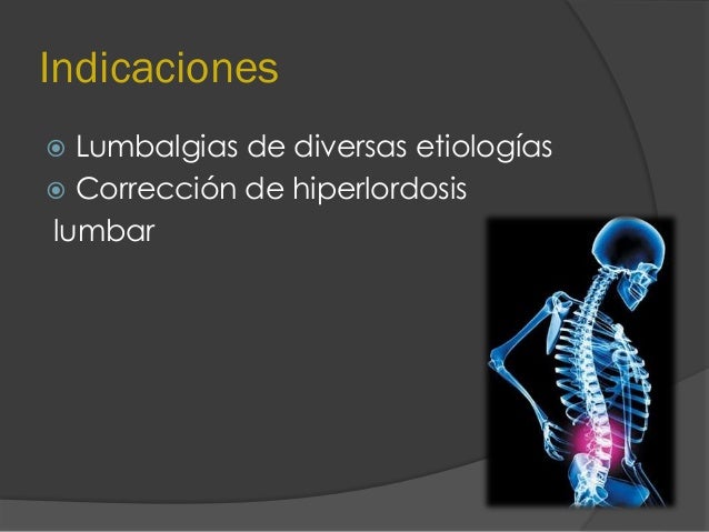 Ejercicios de Williams