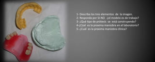1- Describa los tres elementos  de  la imagen.2- Responda por SI-NO   ¿el modelo es de trabajo?3- ¿Qué tipo de prótesis  se  está construyendo?4-¿Cúal  es la proxima maniobra en el laboratorio?5- ¿Cuál  es la proxima maniobra clínica? 