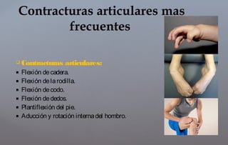  Contracturas articulares:
 Flexión decadera.
 Flexión delarodilla.
 Flexión decodo.
 Flexión dededos.
 Plantiflexión del pie.
 Aducción y rotación internadel hombro.
Contracturas articulares mas
frecuentes
 