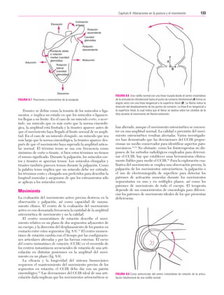 Cap. 08

23/3/06

20:37

Página 133

133
Capítulo 8: Alteraciones en la postura y el movimiento
....................................................................................................................................................
Elevación

Inclinación
anterior
Rotación
ascendente
Cavidad
glenoidea

Aducción

Escápula alada
o rotación
medial (cavidad
glenoidea)

Rotación
descendente

Abducción

Rotación
lateral
(cavidad
glenoidea)

Descenso

FIGURA 8.7 Posiciones y movimientos de la escápula.

Tirantez se define como la tensión de los músculos o ligamentos, e implica un estado en que los músculos o ligamentos llegan a un límite. En el caso de un músculo corto, o acortado, un músculo que es más corto que la norma cinesiológica, la amplitud está limitada y la tirantez aparece antes de
que el movimiento haya llegado al límite normal de su amplitud. En el caso de un músculo elongado, un músculo que sea
más largo que la norma cinesiológica, la tirantez aparece después de que el movimiento haya superado la amplitud articular normal. El término tenso se usa con frecuencia como
sinónimo de corto o tirante, si bien estos términos no tienen
el mismo significado. Durante la palpación, los músculos cortos y tirantes se aprecian tensos. Los músculos elongados y
tirantes también parecen tensos durante la palpación. Como
la palabra tenso implica que un músculo debe ser estirado,
los términos corto y elongado son preferidos para describir la
longitud muscular y asegurarse de que los estiramientos sólo
se aplican a los músculos cortos.

Movimiento
La evaluación del movimiento activo precisa destreza en la
observación y palpación, así como capacidad de razonamiento clínico. El centro de la evaluación del movimiento
activo es con demasiada frecuencia la cantidad de la amplitud
osteocinética de movimiento y no la calidad.
El centro momentáneo de rotación describe el movimiento relativo en un plano de dos segmentos adyacentes de
un cuerpo, y la dirección del desplazamiento de los puntos en
contacto entre estos segmentos (fig. 8.8).11 El centro momentáneo de rotación cambia con el tiempo por las configuraciones articulares alteradas y por las fuerzas externas. El curso
del centro instantáneo de rotación (CCIR) es el recorrido de
los centros instantáneos secuenciales de rotación de una articulación en distintas posiciones en la amplitud del movimiento en un plano (fig. 8.9).
La eficacia y la longevidad del sistema biomecánico
requieren el mantenimiento del movimiento preciso de los
segmentos en rotación; el CCIR debe dar con un patrón
cinesiológico.12 Las desviaciones del CCIR ideal de una articulación dada implican que los movimientos artrocinéticos se

FIGURA 8.8 Una rodilla normal con una línea trazada desde el centro instantáneo
de la articulación tibiofemoral hasta el punto de contacto tibiofemoral (A) forma un
ángulo recto con una línea tangencial a la superficie tibial (B). La flecha indica la
dirección del desplazamiento de los puntos de contacto. La línea B es tangencial a
la superficie tibial, lo cual indica que el fémur se desliza sobre los cóndilos de la
tibia durante el movimiento de flexión-extensión.

han alterado, aunque el movimiento osteocinético se encuentre en una amplitud normal. La calidad o precisión del movimiento osteocinético resultan afectadas. Varios investigadores han demostrado que las desviaciones del CCIR proporcionan un medio conservador para identificar aspectos patomecánicos.13,14 No obstante, como los fisioterapeutas no disponen de los métodos radiológicos empleados para determinar el CCIR, hay que establecer unas herramientas clínicamente fiables para medir el CCIR.12 Para la exploración cualitativa del movimiento se emplea una observación precisa, la
palpación de los movimientos osteocinéticos, la palpación o
el uso de electromiografía de superficie para detectar los
patrones de activación muscular durante los movimientos
segmentarios en uno y en múltiples planos, así como los
patrones de movimiento de todo el cuerpo. El terapeuta
depende de sus conocimientos de cinesiología para diferenciar los patrones de movimiento ideales de los que presentan
deficiencias.

FIGURA 8.9 Curso semicircular del centro instantáneo de rotación de la articulación tibiofemoral de una rodilla normal.

 