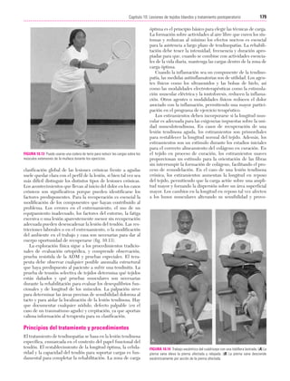 Cap. 10

23/3/06

20:36

Página 179

179
Capítulo 10: Lesiones de tejidos blandos y tratamiento postoperatorio
....................................................................................................................................................

FIGURA 10.13 Puede usarse una codera de tenis para reducir las cargas sobre los
músculos extensores de la muñeca durante los ejercicios.

clasificación global de las lesiones crónicas frente a agudas
suele quedar clara con el perfil de la lesión, si bien tal vez sea
más difícil distinguir los distintos tipos de lesiones crónicas.
Los acontecimientos que llevan al inicio del dolor en los casos
crónicos son significativos porque pueden identificarse los
factores predisponentes. Para la recuperación es esencial la
modificación de los componentes que hayan contribuido al
problema. Los errores en el entrenamiento, el uso de un
equipamiento inadecuado, los factores del entorno, la fatiga
excesiva o una lesión aparentemente menor sin recuperación
adecuada pueden desencadenar la lesión del tendón. Las restricciones laborales o en el entrenamiento, o la modificación
del ambiente en el trabajo y casa son necesarias para dar al
cuerpo oportunidad de recuperarse (fig. 10.13).
La exploración física sigue a los procedimientos tradicionales de evaluación ortopédica, y comprende observación,
prueba resistida de la ADM y pruebas especiales. El terapeuta debe observar cualquier posible anomalía estructural
que haya predispuesto al paciente a sufrir una tendinitis. La
prueba de tensión selectiva de tejidos determina qué tejidos
están dañados y qué pruebas musculares son necesarias
durante la rehabilitación para evaluar los desequilibrios funcionales y de longitud de los músculos. La palpación sirve
para determinar las áreas precisas de sensibilidad dolorosa al
tacto y para aislar la localización de la lesión tendinosa. Hay
que documentar cualquier nódulo, defecto palpable (en el
caso de un traumatismo agudo) y crepitación, ya que aportan
valiosa información al terapeuta para su clasificación.

óptima es el principio básico para elegir las técnicas de carga.
La formación sobre actividades al aire libre que curen los síntomas y reduzcan al mínimo los efectos nocivos es esencial
para la asistencia a largo plazo de tendinopatías. La rehabilitación debe tener la intensidad, frecuencia y duración apropiadas para que, cuando se combine con actividades esenciales de la vida diaria, mantenga las cargas dentro de la zona de
carga óptima.
Cuando la inflamación sea un componente de la tendinopatía, las medidas antiinflamatorias son de utilidad. Los agentes físicos como los ultrasonidos y las bolsas de hielo, así
como las modalidades electroterapéuticas como la estimulación muscular eléctrica y la iontoforesis, reducen la inflamación. Otros agentes o modalidades físicos reducen el dolor
asociado con la inflamación, permitiendo una mayor participación en el programa de ejercicio terapéutico.
Los estiramientos deben incorporarse si la longitud muscular es adecuada para las exigencias impuestas sobre la unidad musculotendinosa. En casos de recuperación de una
lesión tendinosa aguda, los estiramientos son primordiales
para restablecer la longitud normal del tejido. Además, los
estiramientos son un estímulo durante los estadios iniciales
para el correcto alineamiento del colágeno en curación. En
el tejido en proceso de curación, los estiramientos suaves
proporcionan un estímulo para la orientación de las fibras
sin interrumpir la formación de colágeno, facilitando el proceso de remodelación. En el caso de una lesión tendinosa
crónica, los estiramientos aumentan la longitud en reposo
del tejido, permitiendo que la carga actúe sobre una amplitud mayor y forzando la dispersión sobre un área superficial
mayor. Los cambios en la longitud en reposo tal vez afecten
a los husos musculares alterando su sensibilidad y provo-

Principios del tratamiento y procedimientos
El tratamiento de tendinopatías se basa en la lesión tendinosa
específica, enmarcada en el contexto del papel funcional del
tendón. El restablecimiento de la longitud óptima, la celularidad y la capacidad del tendón para soportar cargas es fundamental para completar la rehabilitación. La zona de carga

FIGURA 10.14 Trabajo excéntrico del cuádriceps con una tobillera lastrada. (A) La
pierna sana eleva la pierna afectada y relajada. (B) La pierna sana desciende
excéntricamente por acción de la pierna afectada.

 