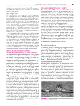 Cap. 10

23/3/06

20:36

Página 183

183
Capítulo 10: Lesiones de tejidos blandos y tratamiento postoperatorio
....................................................................................................................................................
ción. Estos dos factores determinan el ritmo del programa de
rehabilitación y proporcionan al terapeuta los parámetros
para una carga óptima.

DESCOMPRESIÓN
Los procedimientos de descompresión se emplean para aliviar la presión de un área y suelen practicarse en el hombro
para reducir la presión sobre los tejidos blandos subacromiales, y en la columna vertebral para reducir la presión sobre la
médula espinal. Las operaciones de muñeca para aliviar la
presión del túnel carpiano y las fasciotomías en la pierna para
reducir las presiones de los compartimientos pueden considerarse formas de descompresión. La presión excesiva en
estas áreas tal vez se deba a la arquitectura del hueso o los
tejidos blandos, y la descompresión implica la liberación o
exéresis de estos tejidos blandos y el raspado o extirpación de
las fuentes óseas de la presión.
La rehabilitación tras una descompresión está determinada
por la patología primaria y el estado de los tejidos descomprimidos, que depende del grado y duración de la compresión, y
del tipo de tejido comprimido. Por ejemplo, si la presión excesiva sobre un nervio ha provocado cambios neurológicos, la
rehabilitación se centra en la recuperación de la función nerviosa. Si la presión ha causado una alteración de la función
muscular (p. ej., el manguito de los rotadores), la rehabilitación
se centra en la recuperación de la función muscular. A medida
que avanza la rehabilitación, se evitan las actividades o posiciones que compriman en exceso el tejido descomprimido.

ESTABILIZACIÓN Y PROCEDIMIENTOS
DE REALINEAMIENTO DE LOS TEJIDOS BLANDOS
Los procedimientos para la estabilización de tejidos blandos
se practican en casos de inestabilidad articular debida a laxitud capsular. Este procedimiento se practica con mucha frecuencia para corregir la inestabilidad de hombro y tal vez se
combine con otros procedimientos de estabilización (p. ej.,
estabilización ósea). Muchas técnicas quirúrgicas pueden
estabilizar una articulación con laxitud capsular. Igualmente,
los procedimientos para la realineación de tejidos blandos se
practican para modificar la tracción de los tejidos blandos
que pueden ser el resultado de una inestabilidad. Por ejemplo, el recentraje rotuliano proximal se emplea para mejorar
la tracción eficaz del músculo vasto medial oblicuo sobre la
rótula. Con independencia del procedimiento, la fijación
suele ser de tejido blando en tejido blando, sin estabilidad
ósea.
Dada la falta de fijación rígida y el largo período de tiempo
necesario para que cure el tejido blando, las cargas impuestas sobre el lugar de la reparación se controlan cierto tiempo
después de la estabilización. Por ejemplo, cuando se estabiliza el hombro por inestabilidad glenohumeral anteroinferior,
la rotación externa se limita un período corto después de la
operación para que se cure la cápsula anterior. Como el
tejido reparado no es contráctil, se suele permitir una pronta
activación muscular durante la rehabilitación, siempre y
cuando se tengan en cuenta las precauciones para la ADM. A
medida que avanza la rehabilitación y aumenta la amplitud
sometiendo a tensión el tejido reparado, hay que estar alerta
ante posibles signos de laxitud progresiva de la reparación,
como manifestaciones de deslizamiento o inestabilidad. La
recuperación de la movilidad debe ser completa, sin recidivas
de los síntomas de inestabilidad.

REPARACIONES DE MENISCOS Y RODETE
Los meniscos de la rodilla y los rodetes del hombro son dos
puntos habituales de reparación del fibrocartílago. Las roturas del rodete glenoideo son más difíciles de identificar, y las
técnicas de reparación no están tan desarrolladas como las
del menisco. La reparación de meniscos rotos de la rodilla
suele realizarse sola o combinada con otros procedimientos
con reconstrucción del LCA. En el caso concreto de la rodilla, la menor es de un tejido blando con un riego sanguíneo
menor. La curación puede mejorar con procedimientos asociados para aumentar el riego sanguíneo del área.
Aspectos importantes de la rehabilitación son el conocimiento de las cargas que soporta la reparación cuando la articulación adopta distintas posiciones. Estas posiciones deben
evitarse durante los estadios iniciales cuando la reparación es
todavía frágil. Por ejemplo, la flexión completa de la rodilla
en carga se limita durante varias semanas después de una
reparación de menisco, ya que esta posición impone grandes
cargas sobre el menisco. Las posiciones de extensión completa por encima de la cabeza deben evitarse después de la
reparación del rodete glenoideo en la zona superior. Hay que
mantener comunicación con el cirujano sobre aspectos como
la localización y extensión del tejido reparado.

Procedimientos óseos
A menudo se necesita la rehabilitación después de procedimientos quirúrgicos óseos con el fin de restablecer el movimiento de las articulaciones adyacentes, fortalecer los tejidos
blandos relacionados y aumentar la resistencia general.
Algunas intervenciones tienen un efecto directo sobre el
hueso y pueden mejorar el proceso de curación. El procedimiento específico, los daños hísticos y la salud general del
paciente, equilibrados con los principios de la carga óptima y
las AEEI, determinan las elecciones de intervención.

CONDROPLASTIA POR ABRASIÓN
La condroplastia por abrasión es un procedimiento que se
realiza solo o combinado con otros procedimientos en casos
de lesiones del cartílago articular. Este procedimiento se
practica sobre todo en la rodilla, donde las lesiones del cartílago articular pueden ser producto de una artropatía degenerativa o una lesión aguda. Estas lesiones causan deficiencias
como dolor, tumefacción y pérdida de movimiento, así como
limitaciones funcionales tales como incapacidad para caminar ciertas distancias, permanecer de pie largo tiempo o subir
escaleras. Después de que hayan fallado otras medidas conservadoras para resolver las deficiencias y limitaciones fun-

FIGURA 10.15 El uso de actividades en un medio desgravado permite cargar progresivamente las extremidades inferiores.

 