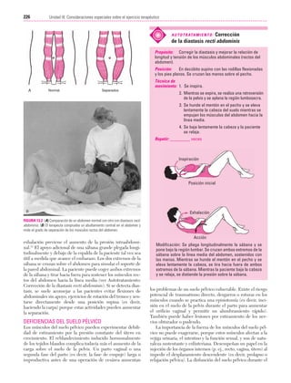 Ejercicio terapeutico recuperacion funcional