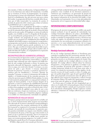 Ejercicio terapeutico recuperacion funcional