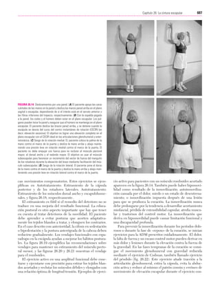 Ejercicio terapeutico recuperacion funcional