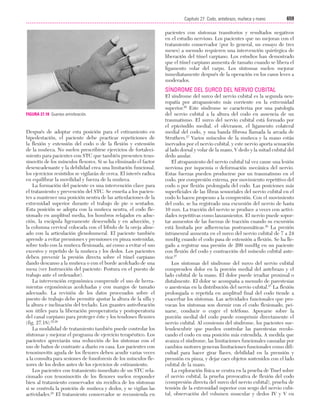 Ejercicio terapeutico recuperacion funcional