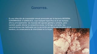 Gonorrea.


Es una infección de transmisión sexual provocada por la bacteria NEISSERIA
GONORRHOEAE O GONOCOCO, cuyo huésped especifico es el ser humano
afecta principalmente las mucosas del aparato genital y urinario, pero
también puede afectar la conjuntiva ocular, la faringe y el recto. Sus
características mas habituales son la secreción purulenta por la uretra en el
hombre y la consecuencia de infertilidad en la mujer

 