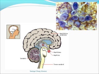 Santiago Chung Alcarazo
 
