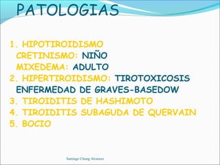 PATOLOGIAS

1. HIPOTIROIDISMO
 CRETINISMO: NIÑO
 MIXEDEMA: ADULTO
2. HIPERTIROIDISMO: TIROTOXICOSIS
 ENFERMEDAD DE GRAVES-BASEDOW
3. TIROIDITIS DE HASHIMOTO
4. TIROIDITIS SUBAGUDA DE QUERVAIN
5. BOCIO


          Santiago Chung Alcarazo
 