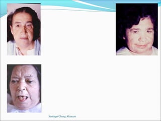 Santiago Chung Alcarazo
 