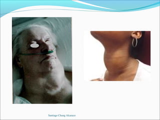 Santiago Chung Alcarazo
 