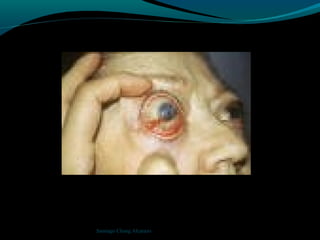 Santiago Chung Alcarazo
 