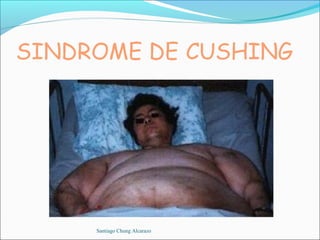 Santiago Chung Alcarazo
 