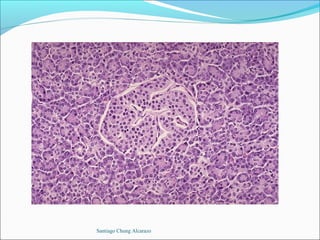 Santiago Chung Alcarazo
 