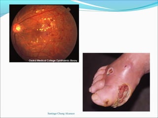 Santiago Chung Alcarazo
 