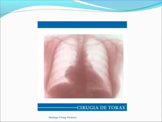 Santiago Chung Alcarazo
 