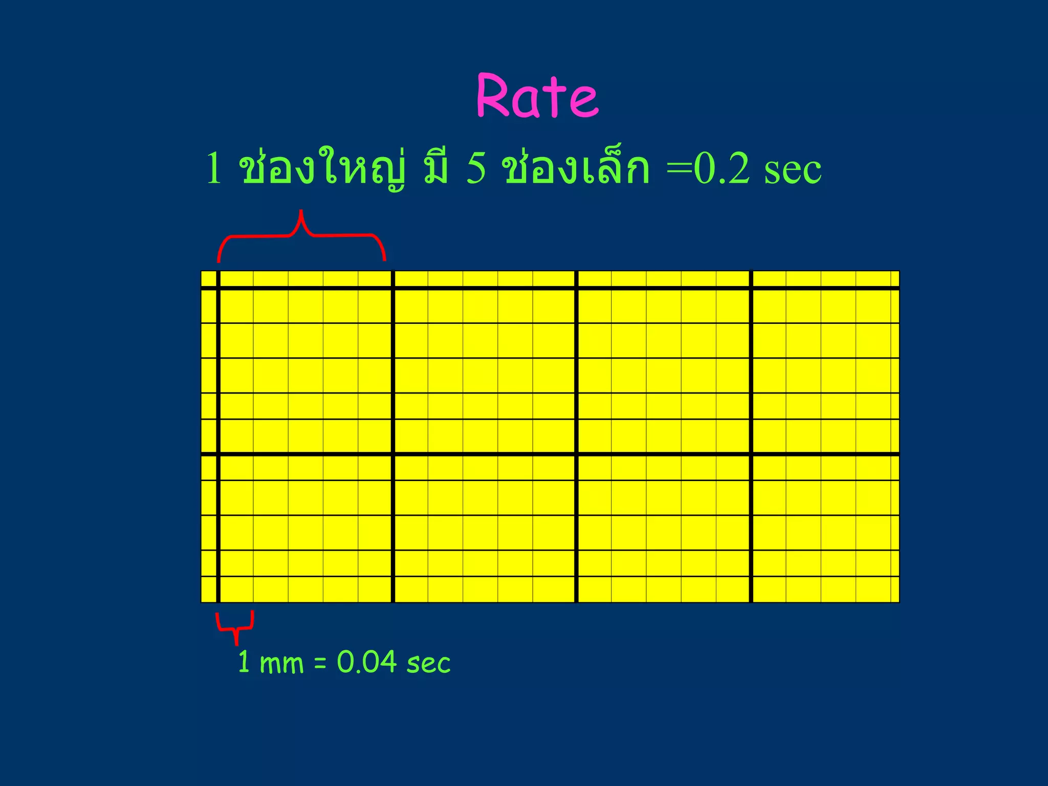 1 mm = 0.04 sec 1  ช่องใหญ่ มี  5  ช่องเล็ก  =0.2 sec Rate 