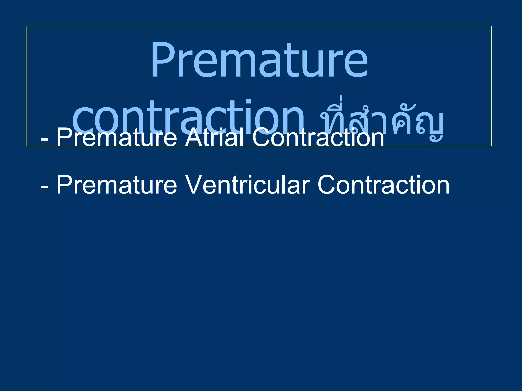 Premature contraction   ที่สำคัญ - Premature Atrial Contraction - Premature Ventricular Contraction 