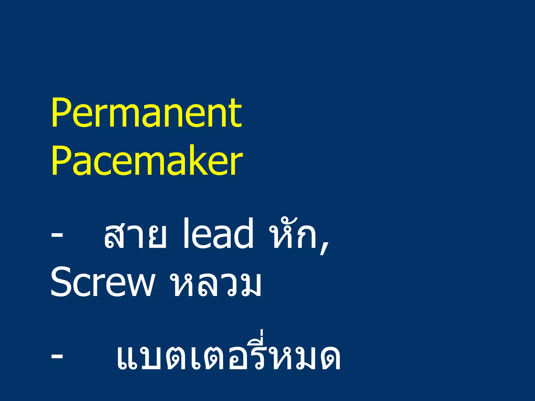 Permanent Pacemaker สาย  lead  หัก ,  Screw  หลวม -  แบตเตอรี่หมด 