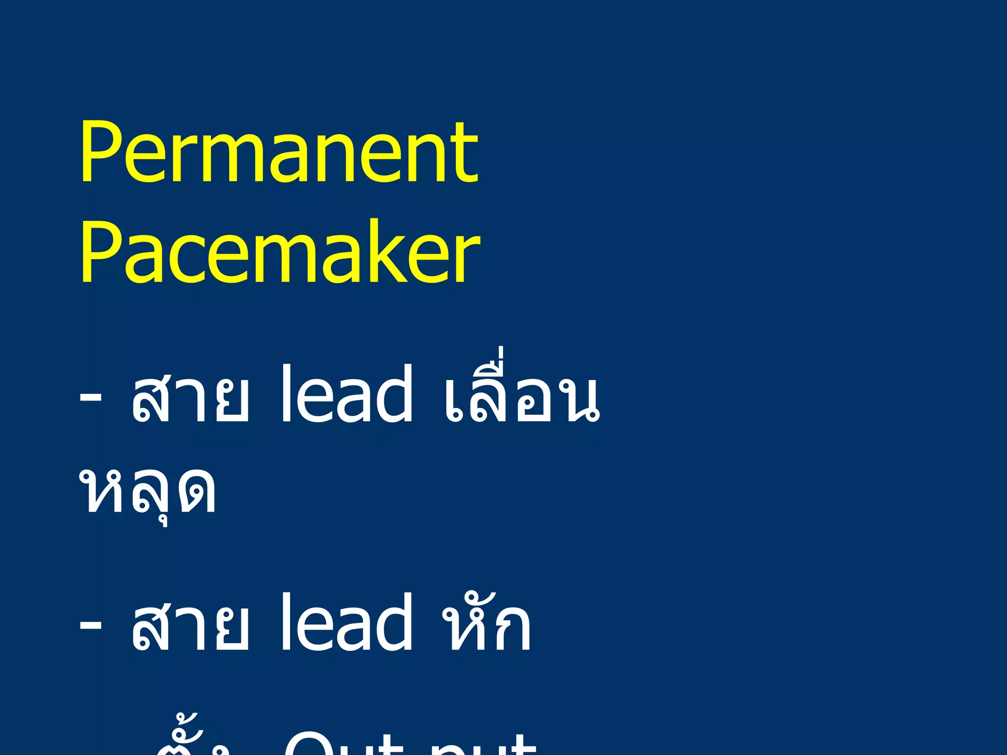 Permanent Pacemaker -  สาย  lead  เลื่อนหลุด สาย  lead  หัก -  ตั้ง  Out put  ต่ำเกินไป 