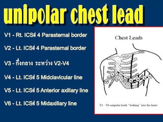 unipolar chest lead 