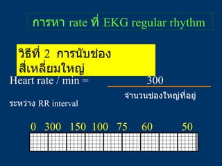 การหา  rate  ที่  EKG regular rhythm  วิธีที่  2  การนับช่องสี่เหลี่ยมใหญ่ Heart rate / min =  300 จำนวนช่องใหญ่ที่อยู่ระห...