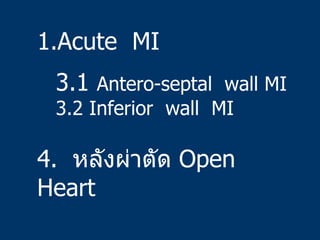 <ul><li>Acute  MI </li></ul><ul><li>3.1  Antero-septal  wall MI 3.2 Inferior  wall  MI </li></ul>4.  หลังผ่าตัด  Open Heart 