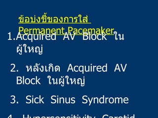 ข้อบ่งชี้ของการใส่  Permanent Pacemaker <ul><li>Acquired  AV  Block  ในผู้ใหญ่ </li></ul><ul><li>2.  หลังเกิด  Acquired  A...