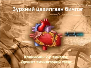 Зүрхний цахилгаан бичлэг




   Клиникийн 2-р эмнэлэг
  Эрчимт эмчилгээний тасаг
 