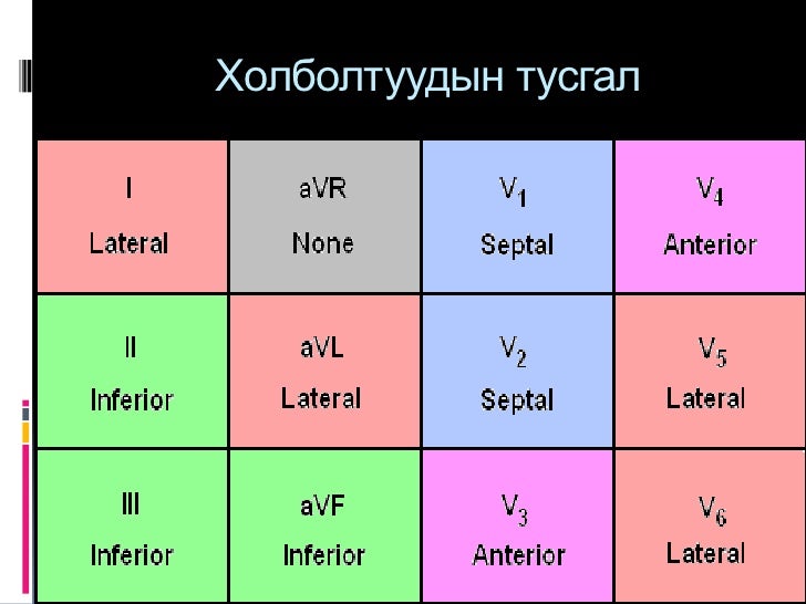 Ekg