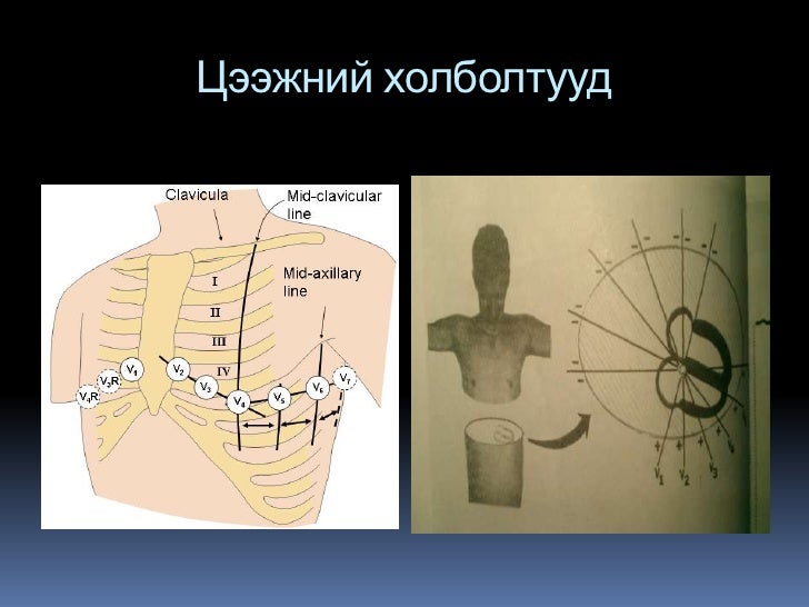 Ekg