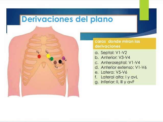 Electrocardiograma