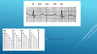  Método de Dublin.
 