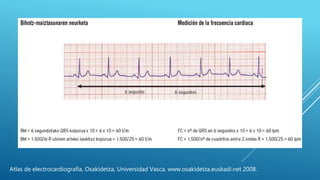 Atlas de electrocardiografía, Osakidetza, Universidad Vasca, www.osakidetza.euskadi.net 2008.
 