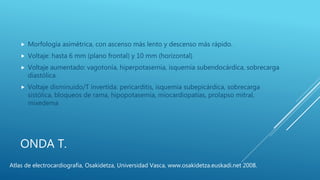 ONDA T.
 Morfología asimétrica, con ascenso más lento y descenso más rápido.
 Voltaje: hasta 6 mm (plano frontal) y 10 mm (horizontal)
 Voltaje aumentado: vagotonía, hiperpotasemia, isquemia subendocárdica, sobrecarga
diastólica.
 Voltaje disminuido/T invertida: pericarditis, isquemia subepicárdica, sobrecarga
sistólica, bloqueos de rama, hipopotasemia, miocardiopatías, prolapso mitral,
mixedema
Atlas de electrocardiografía, Osakidetza, Universidad Vasca, www.osakidetza.euskadi.net 2008.
 