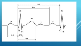 Ekg