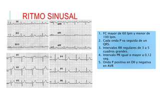 RITMOS ELECTROCARDIOGRAMA | PPTX